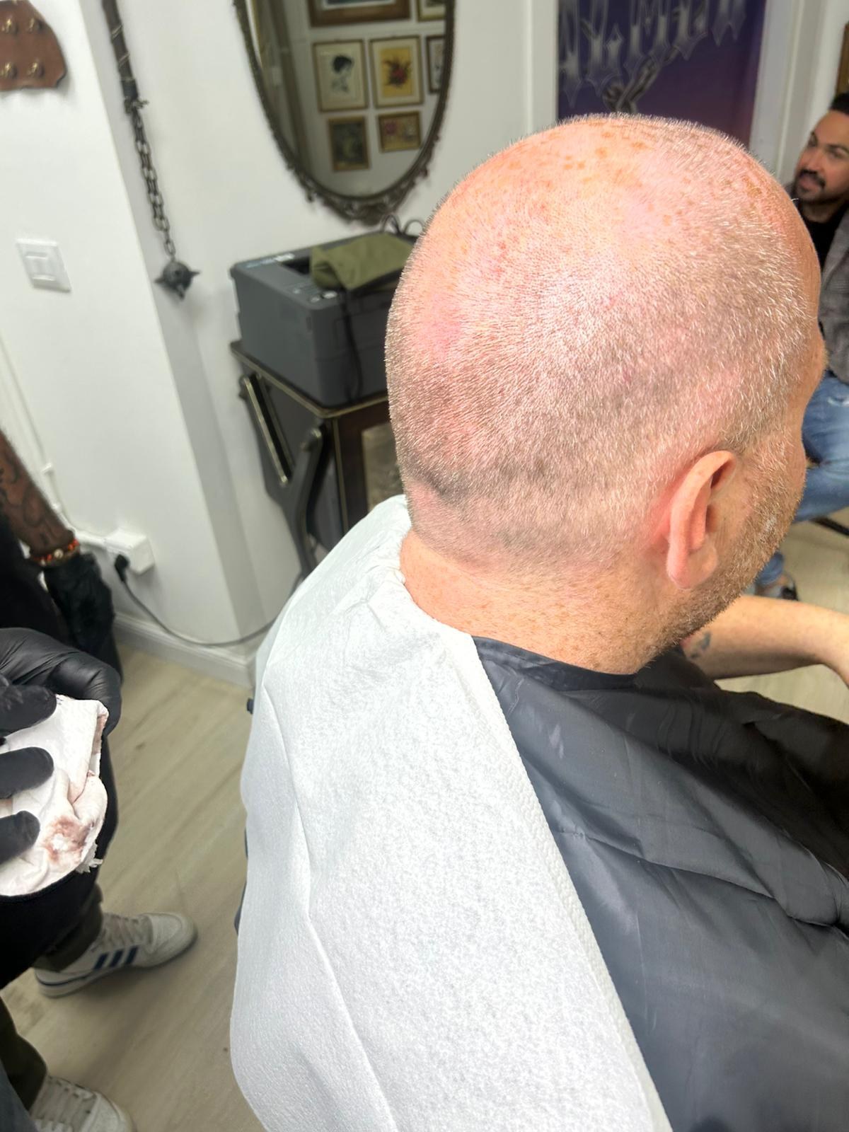 Nuca rasata di uomo con puntini di pigmento sul cuoio capelluto, mantella nera e salvietta bianca, studio Saloon Kitch